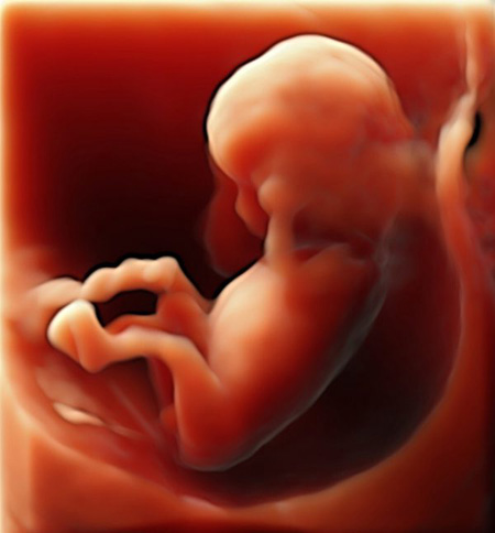 3D-Fetus, Ultraschall-Aufnahme in der 14. Schwangerschaftswoche